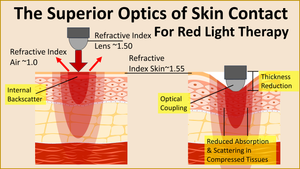 The Superior Optics of Skin Contact for Red Light Therapy