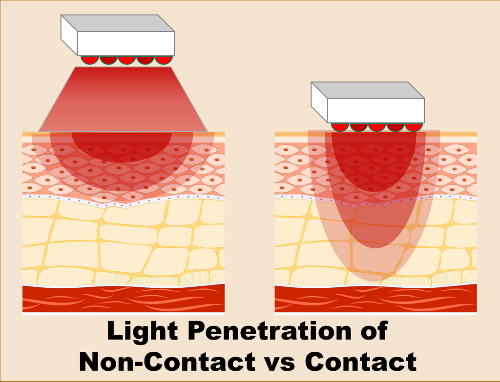 True Medical Grade Red Light Therapy Skin Contact Deep